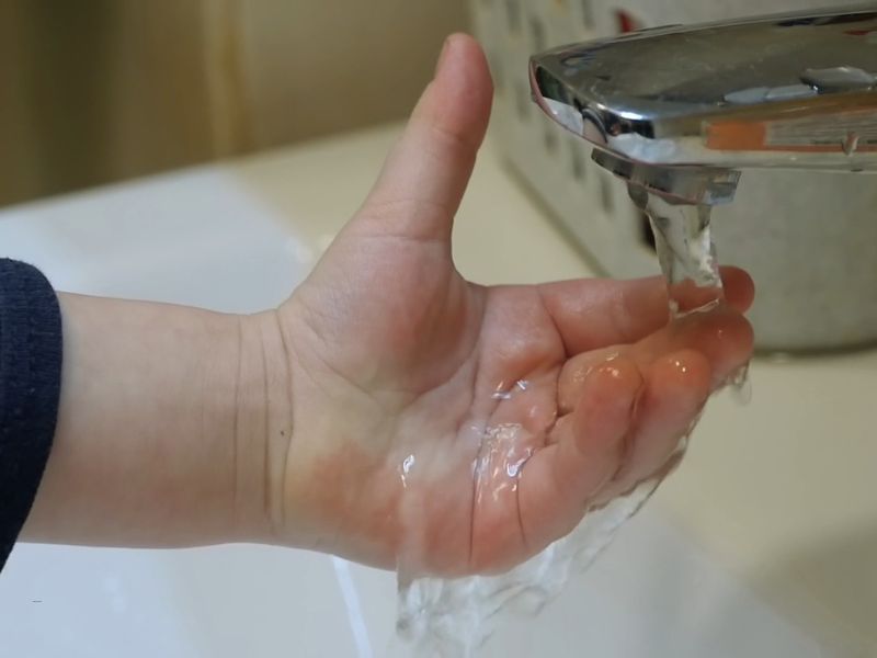 dete hladi ruku nakon što se ispeklo